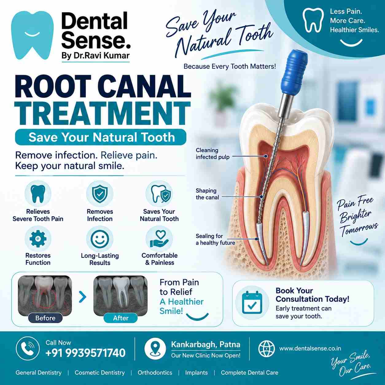 Best Kids Dentist In Patna | Complete Guide – Dental Sense